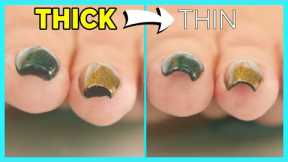 Thick Ugly Nails? QUICK HACK To Thin