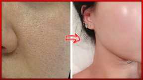 𝟖 𝐖𝐈𝐍𝐓𝐄𝐑 𝐒𝐊𝐈𝐍 𝐂𝐀𝐑𝐄 𝐓𝐈𝐏𝐒 For All Skin Problems and get Healthy & Glowing Skin | Beauty Tips