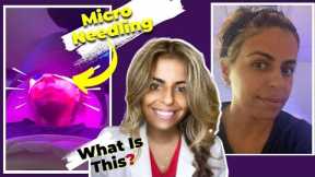 What is microneedling? || Skin Care Micro Needling Beauty Tips