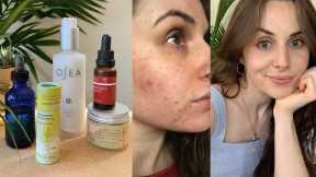 My Skin Care Routine & How I Cleared my Acne Without Fancy Products | minimalist & low waste
