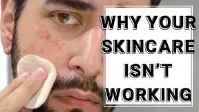Why Your Skin Care Routine Isn't Working - Skincare Tips And tricks ✖ James Welsh