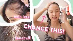 4 Reasons WHY Your Hair Loss & Dandruff ISN’T Getting BETTER + 5 TIPS!
