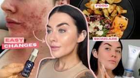 Complete Guide to Achieving Flawless Skin: Diet, Skincare Routine & Treatments