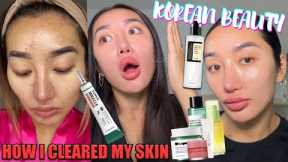 HOW I TRANSFORMED MY SKIN WITH KOREAN BEAUTY SKINCARE! UPDATED SKINCARE ROUTINE | #kbeauty