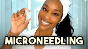 Microneedling: What you need to know, from a dermatologist and Skin of color Expert
